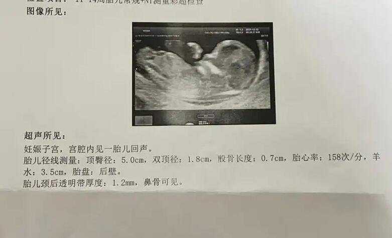 怀孕几周可以去香港验血知男女_怀孕后到香港验血查男女真的准吗_我花了260