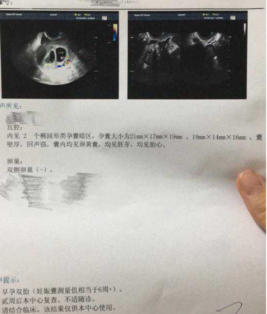 香港验血的血能保存几天,大龄做试管婴儿一超显示双胎，“老来得子”真不容